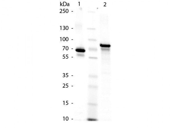 Human Transferrin