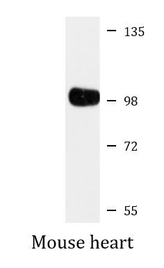 Anti-USP13