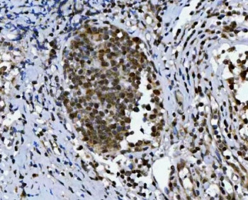 Anti-TRIR / Telomerase RNA component interacting RNase