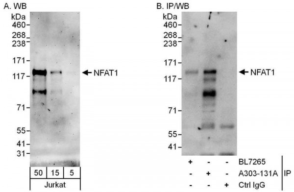 Anti-NFAT1