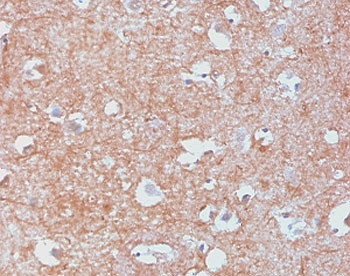 Anti-Neurofilament (-Light) / NF-L / NEFL, clone MSI27-2R