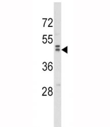 Anti-WNT10B