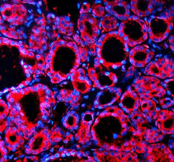 Anti-SPOCK1 / Testican 1