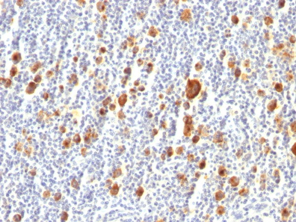 Anti-CD30 / TNFRSF8 (Hodgkin &amp; Reed-Sternberg Cell Marker), clone Ber-H2