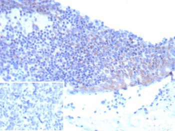 Anti-CD25 / IL2RA, clone IL2RA/9378R