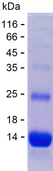 Recombinant Human FZD5 Protein