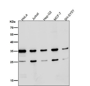 Anti-phospho-Nucleophosmin (Ser125) / NPM1, clone 32N71