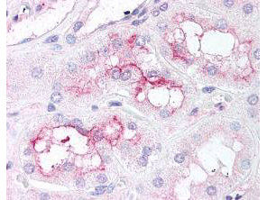 Anti-phospho-mTOR (Ser2448) (mTAb1, Mammalian Target of Rapamycin, FRAP, RAFT)