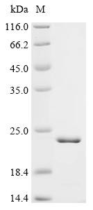 Cyclic nucleotide-gated cation channel beta-1 (CNGB1), partial, recombinant human