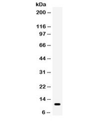 Anti-CCL5 / RANTES