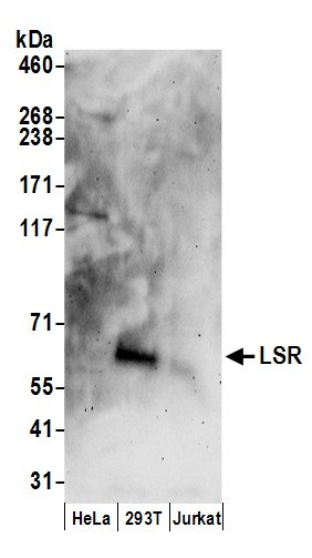 Anti-LSR