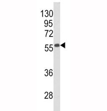 Anti-Beclin1