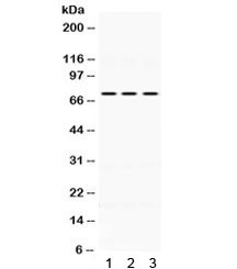 Anti-IL-2 Receptor (beta subunit)