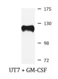 Anti-phospho-JAK2 (Tyr1007/1008)