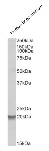 Anti-Bcl 2A1