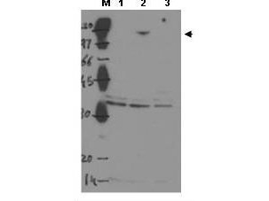 Anti-ASPP2