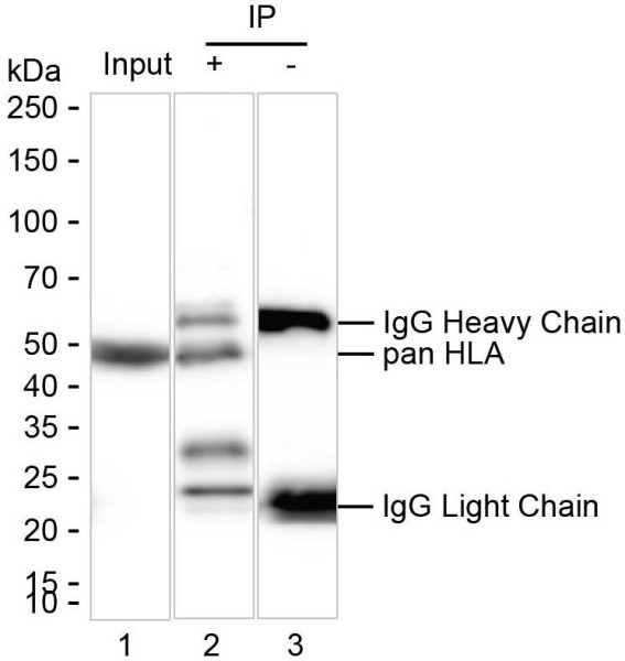 Anti-beta-2-Microglobulin