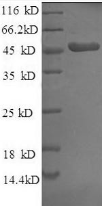 Fibroblast growth factor 19 protein (FGF-19), partial, human, recombinant