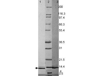 Granulocyte Macrophage Colony Stimulating Factor, human recombinant (rHuGM-CSF)