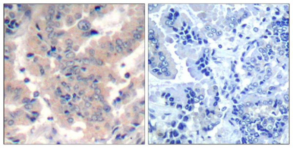 Anti-PI3 Kinase p85/p55