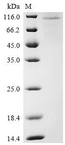 Protein mono-ADP-ribosyltransferase PARP3 (PARP3), human, recombinant