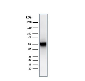Anti-Thymidine Phosphorylase / PD-ECGF, clone rTYMP/3444