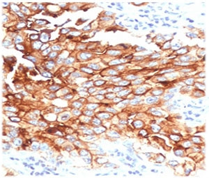 Anti-Mesothelin / MSLN, clone MKPF-1