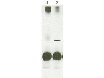 Anti-STAT4 (Signal Transducer and Activator of Transcription 4)