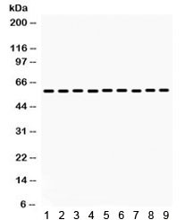 Anti-Monoamine Oxidase B / MAOB