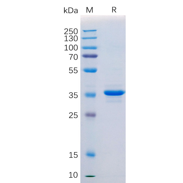 Human CD20 Protein, hFc Tag