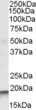Anti-ARPC4, Internal