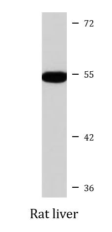 Anti-PFKFB2