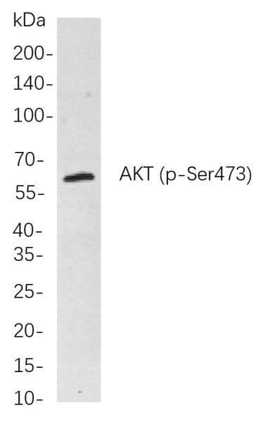Anti-Recombinant Phospho-Akt (pan) (Ser473), clone 9C7
