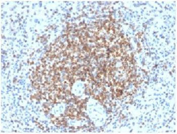 Anti-Bcl-2 (Apoptosis&amp; Follicular Lymphoma Marker) Recombinant Rabbit Monoclonal Antibody (clone:BCL