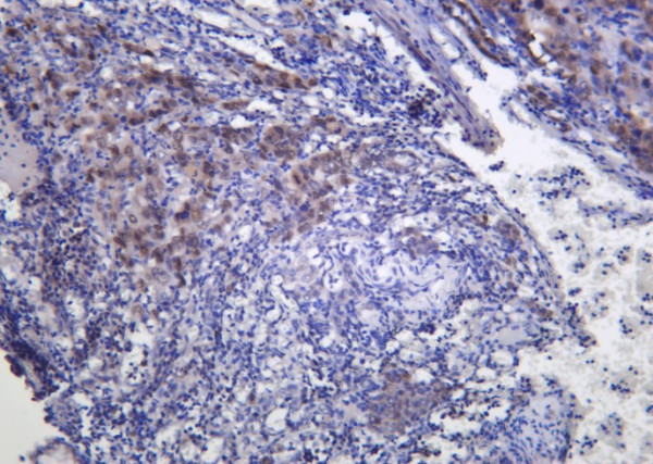 Anti-Recombinant FRA1, clone 2D7