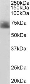 Anti-SLC6A4 / 5HTT / SERT, Internal