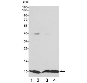 Anti-S100A6, clone 3E11-E9-D8