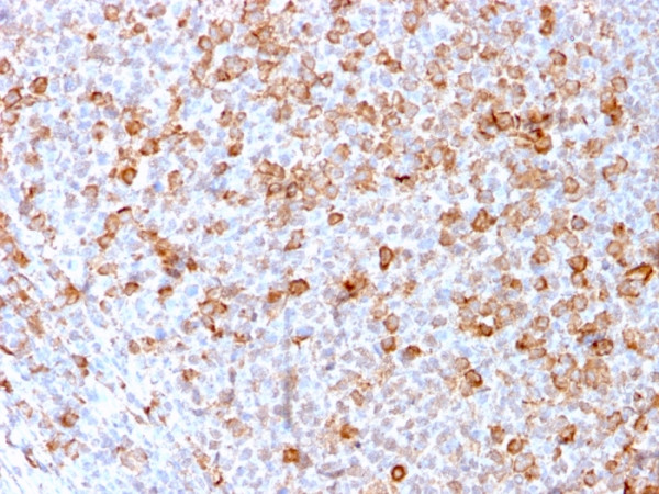 Anti-CD3e (T-Cell Marker), recombinant antibody, clone C3e/3171R
