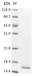Bromodomain-containing protein 2 (BRD2), partial, recombinant human