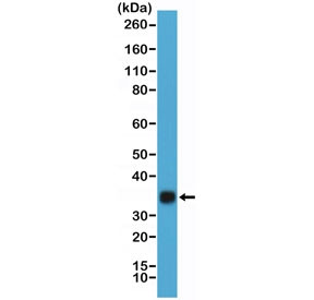 Anti-HCGb / Human Chorionic Gonadotropin beta, clone RM330
