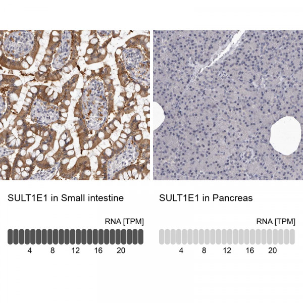 Anti-SULT1E1
