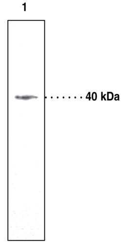 Anti-LPAR3 / EDG7
