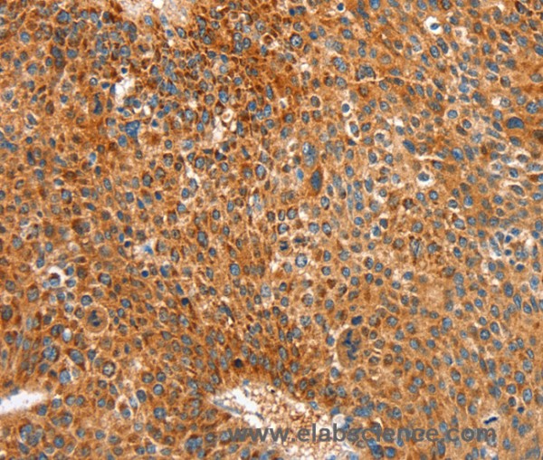 Anti-ALDH1A2