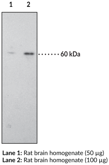 Anti-CB1 Receptor