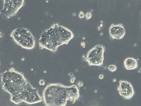 HROC50 T1 M5 Cells