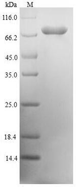 mRNA-decapping enzyme 1A (DCP1A), human, recombinant
