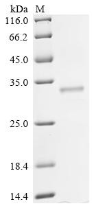 Protein mono-ADP-ribosyltransferase PARP16 (PARP16), partial, recombinant human