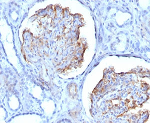 Anti-WT1 / Wilms Tumor 1, clone RMWT1-1