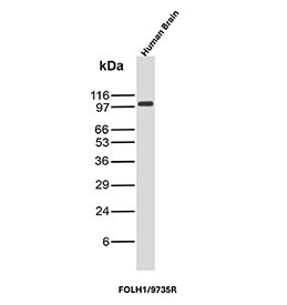 Anti-FOLH1 / Prostate-specific membrane antigen, clone FOLH1/9735R