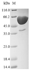 Delta-like protein 3 (DLL3), partial, human, recombinant